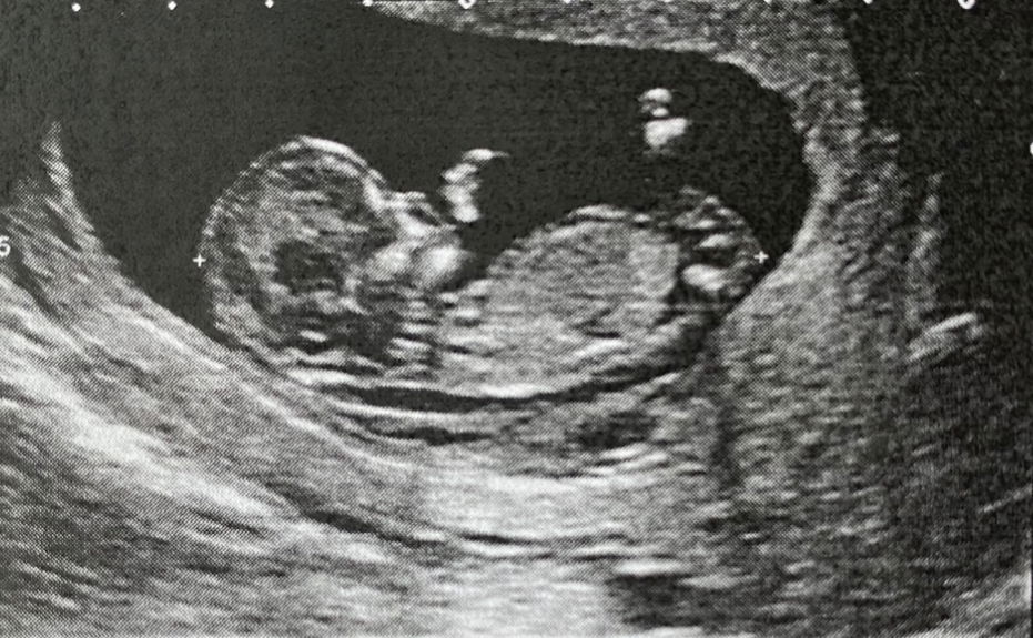 Lindsey Lim profile icon