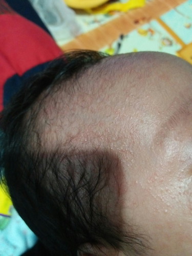 bayi