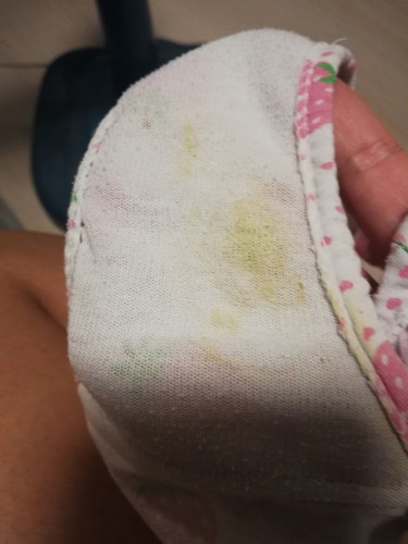 ลูกสาวเป็นตกขาว