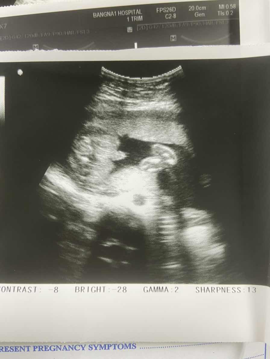 แบบนี้ผชหรือผญคะ