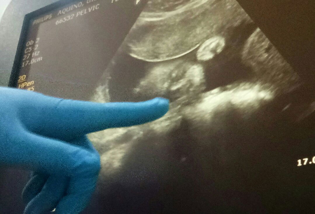 selle Aquino profile icon