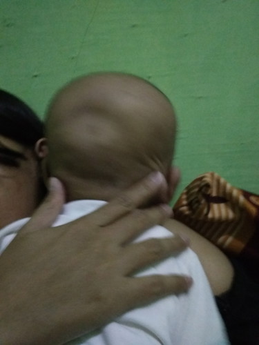 cekungan di kepala bayi