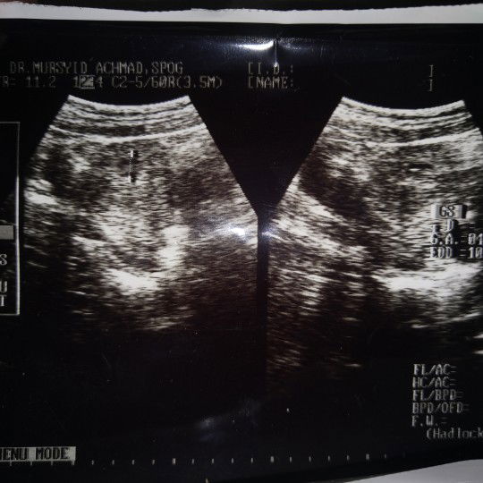 A. Ananda profile icon