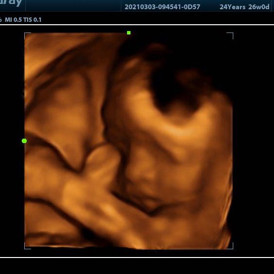 Zakia Zf profile icon