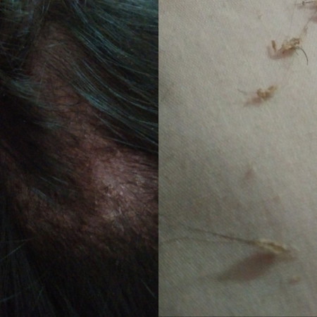 สวัสดีค่ะบ้านไหนลูกเคยเป็นแบบนี้บ้างคะ