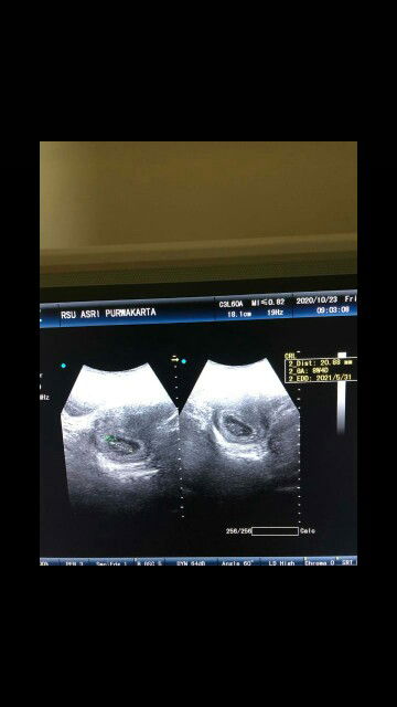 endah ade puteri profile icon