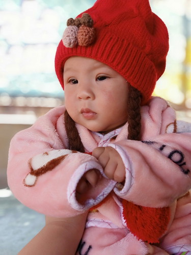 แก้มแตก