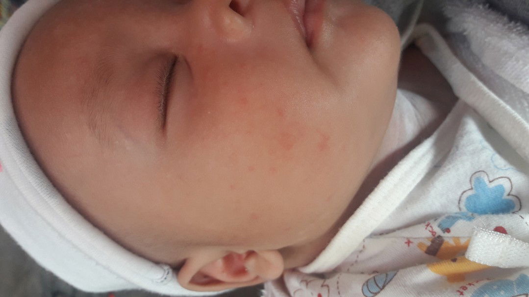 ตุ่มน้ำนม