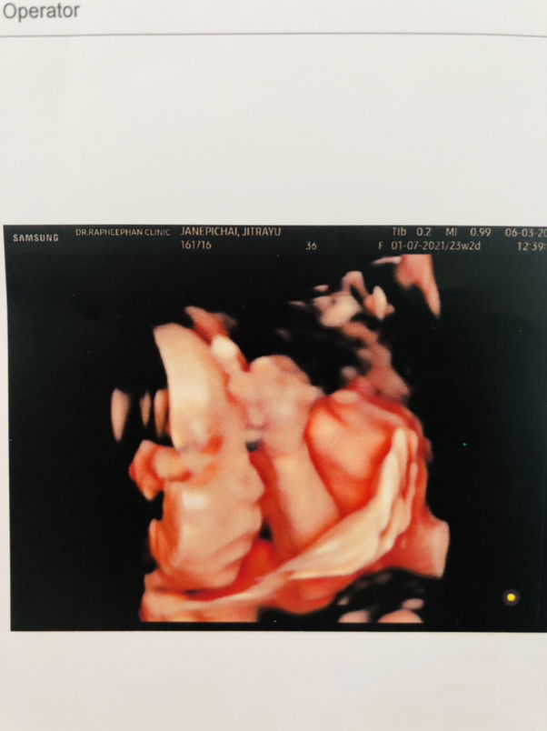 Jitrayu Janepichai profile icon