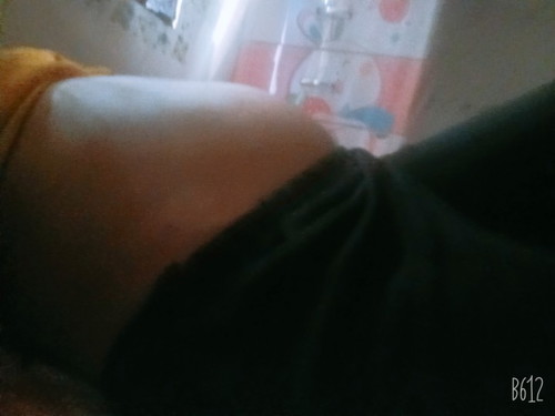 Con so 20 tuần
Các mẹ đoán thử trai hay gái ạ