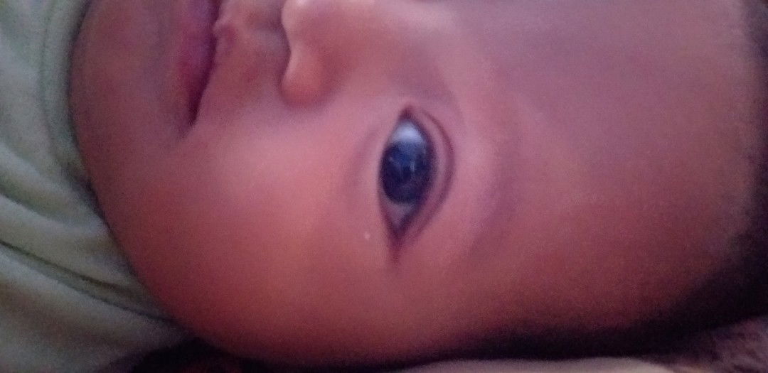 ini penyakit atau bukan