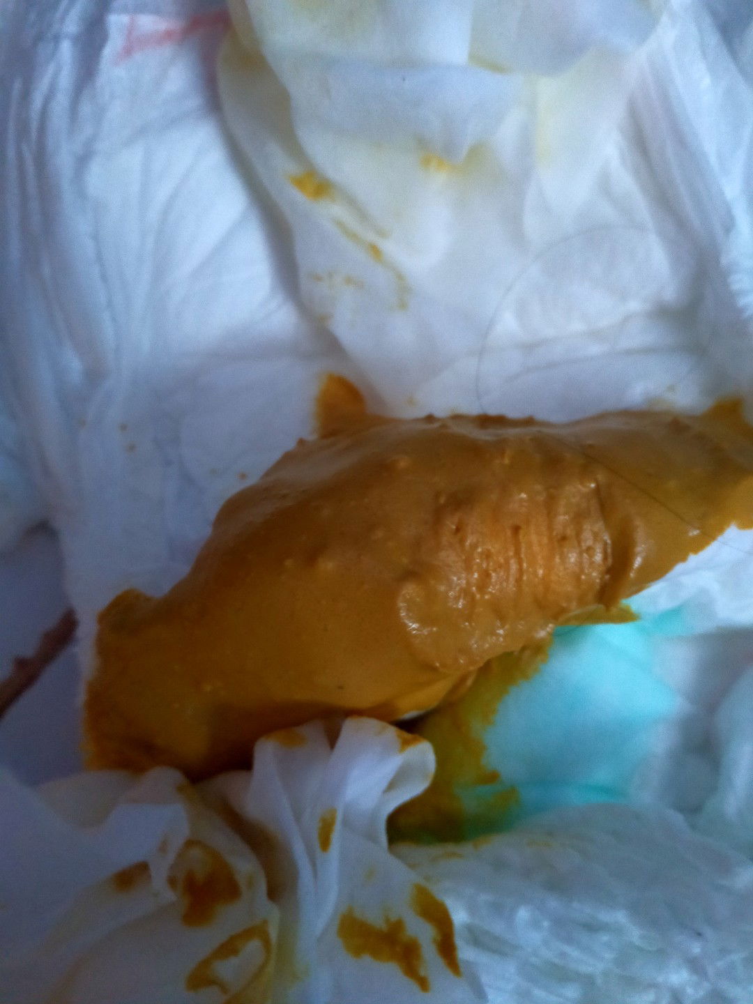 Ada ka ini trmasuk sembelit
Maaf agak jijik