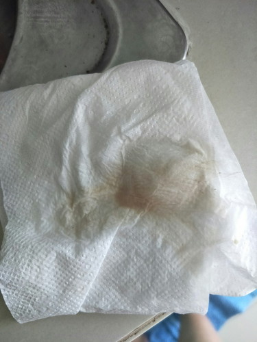 สอบถามแม่ๆหน่อยค่ะ รูปภาพไม่สุภาพนะค่ะ ขออภัยด้วยค่ะ