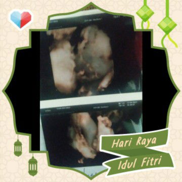 siti ratna sari profile icon