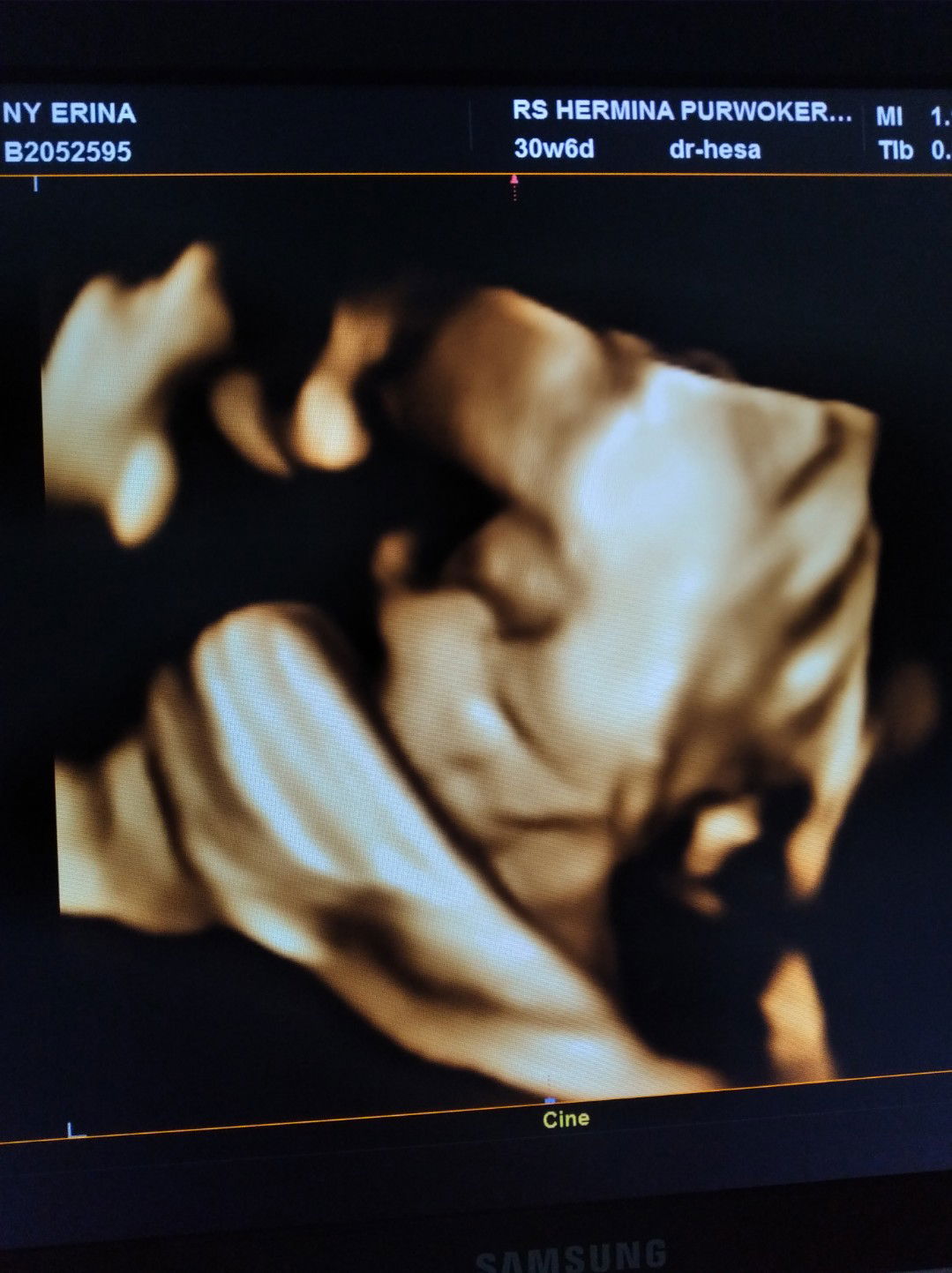 Erina Agustin profile icon