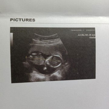 Umi Kulsum Sumiati profile icon