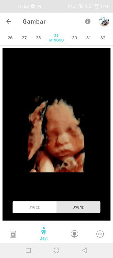 Arista Ajalah profile icon