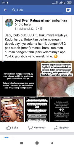 MENGENAI YANG SERING NANYA TENTANG USG