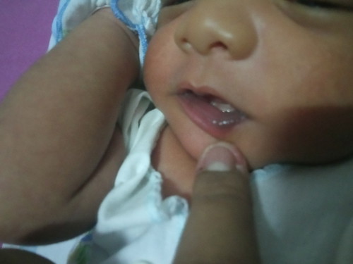 bibir bayi hitam dan membiru