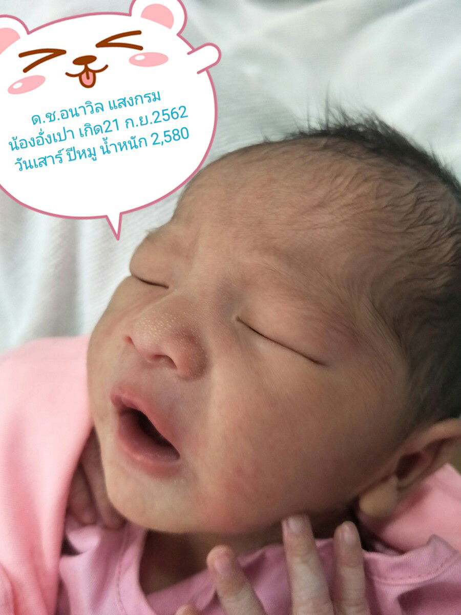 มีใครเคยคลอดน้องแบบเอามือออกมาก่อนบ้างคะ