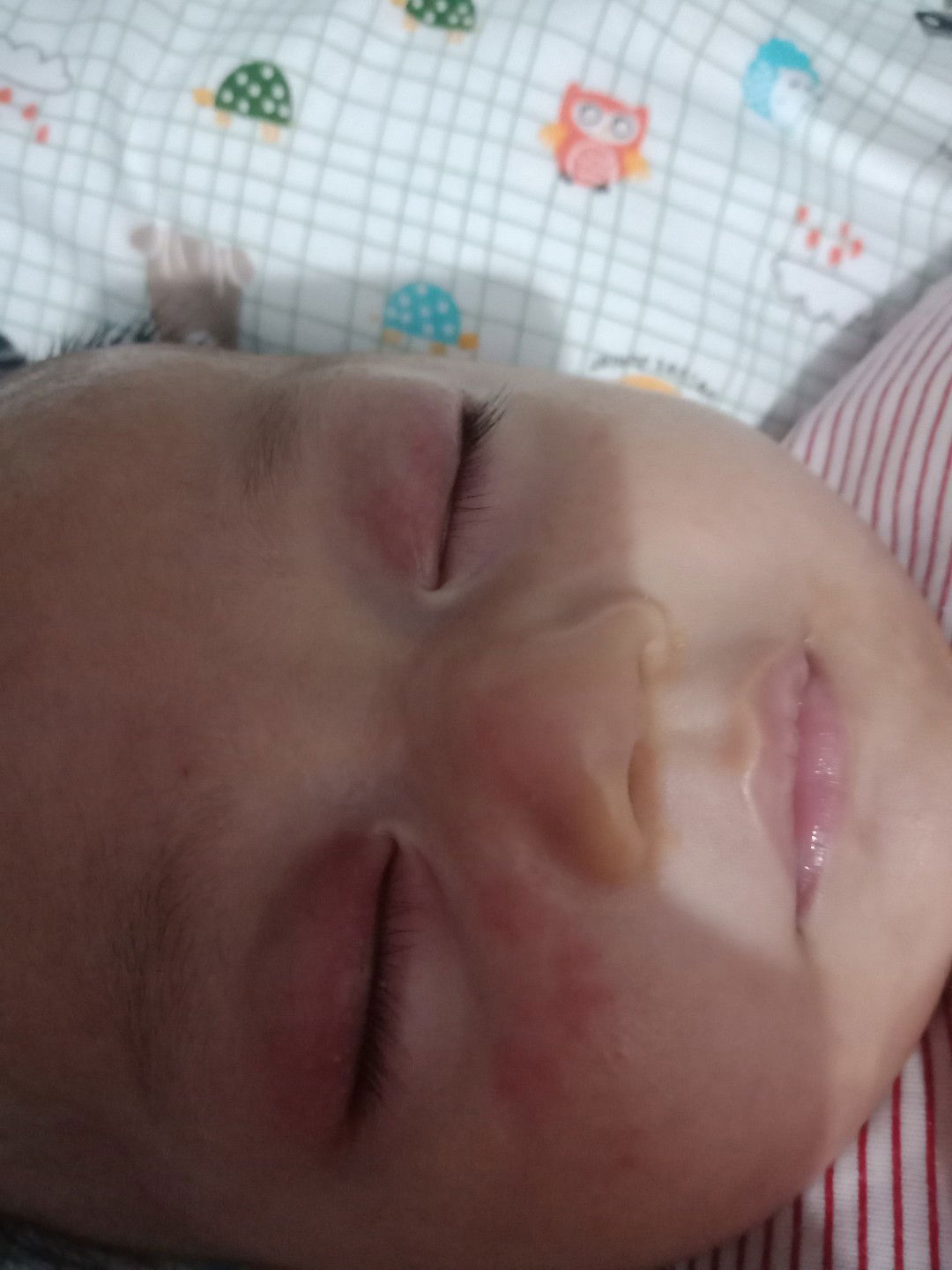 kelopak mata merah ada bintik kecil knp ya bun?