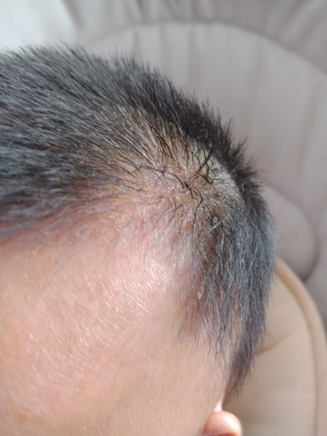 kuning di kepalan dan basah