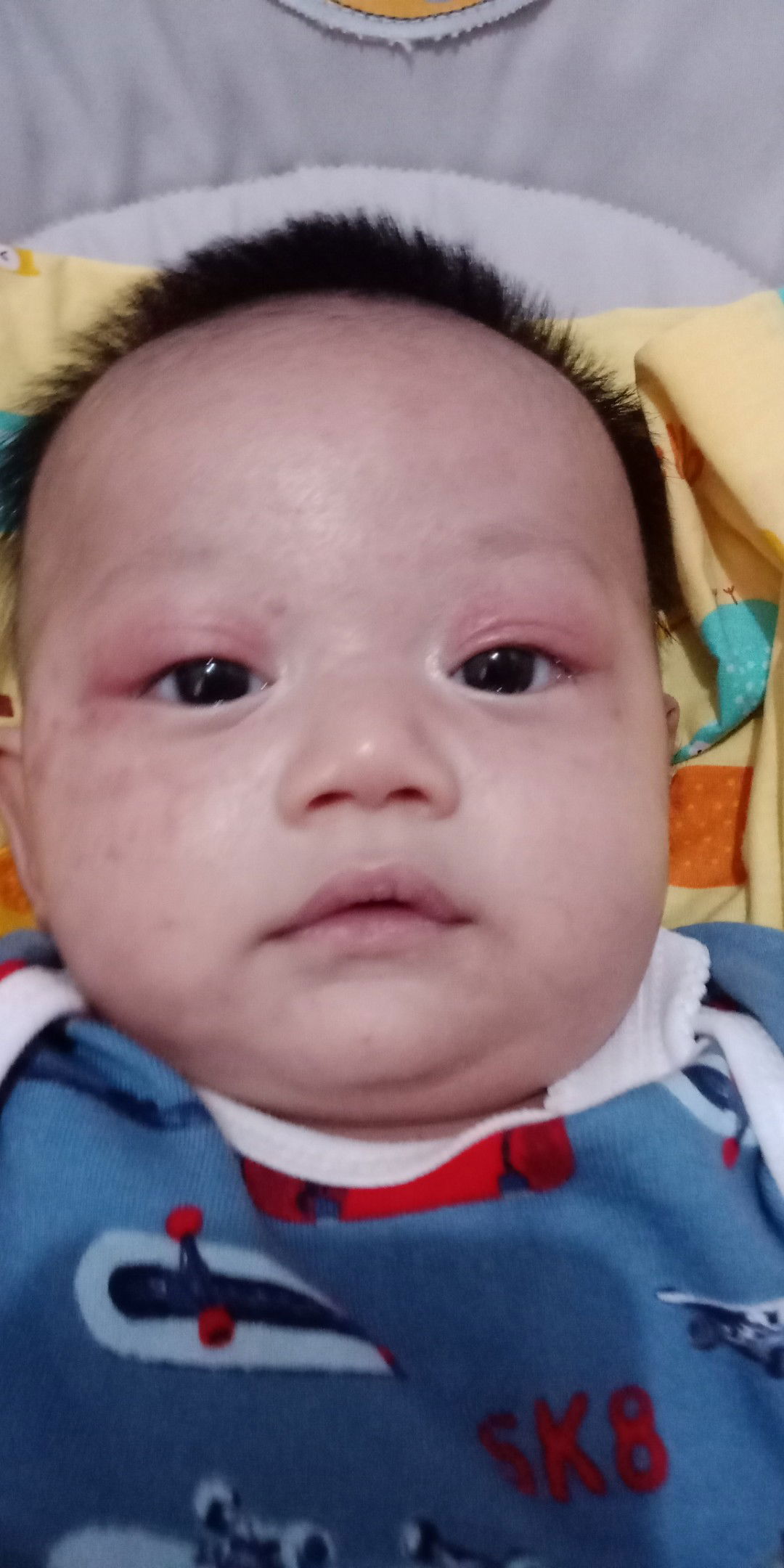 bayi batuk