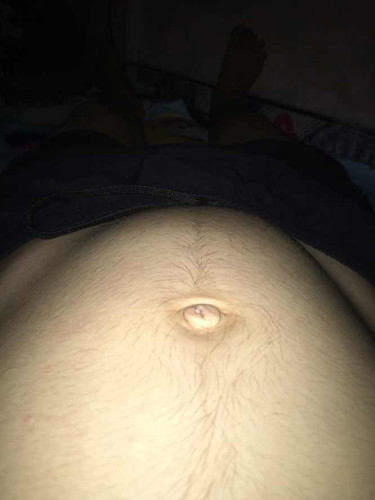 แม่ๆค่ะท้องแบบนี้ปกติไหมค่ะ