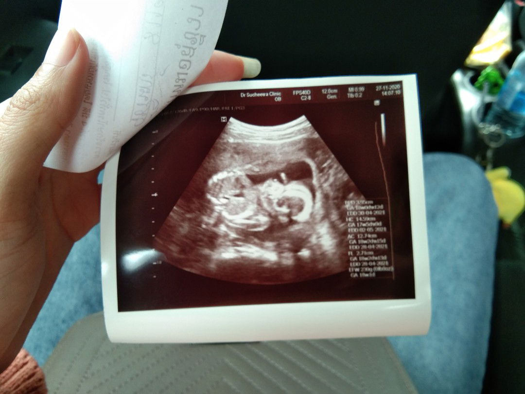 ไม่ระบุ profile icon