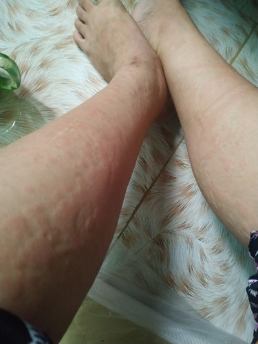 sino nakaranas ng ganito mga mommy meron po kasi ako ngayon nagpapabreastfeed po ako worried lng ako