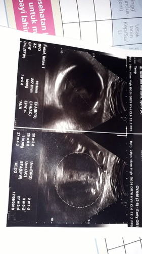 Cara baca hasil print out usg