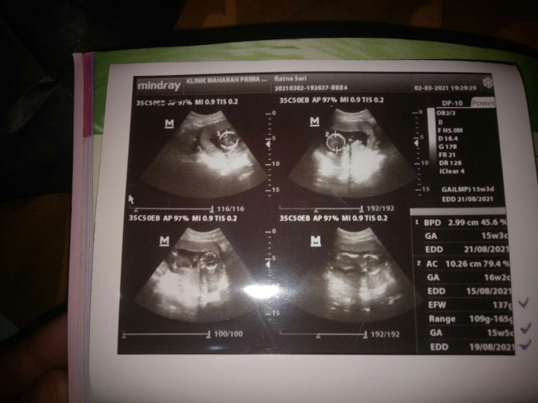 Ratna Sari profile icon