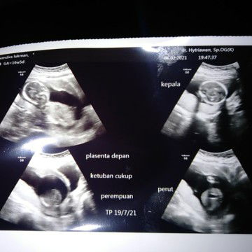 ayu wandira profile icon