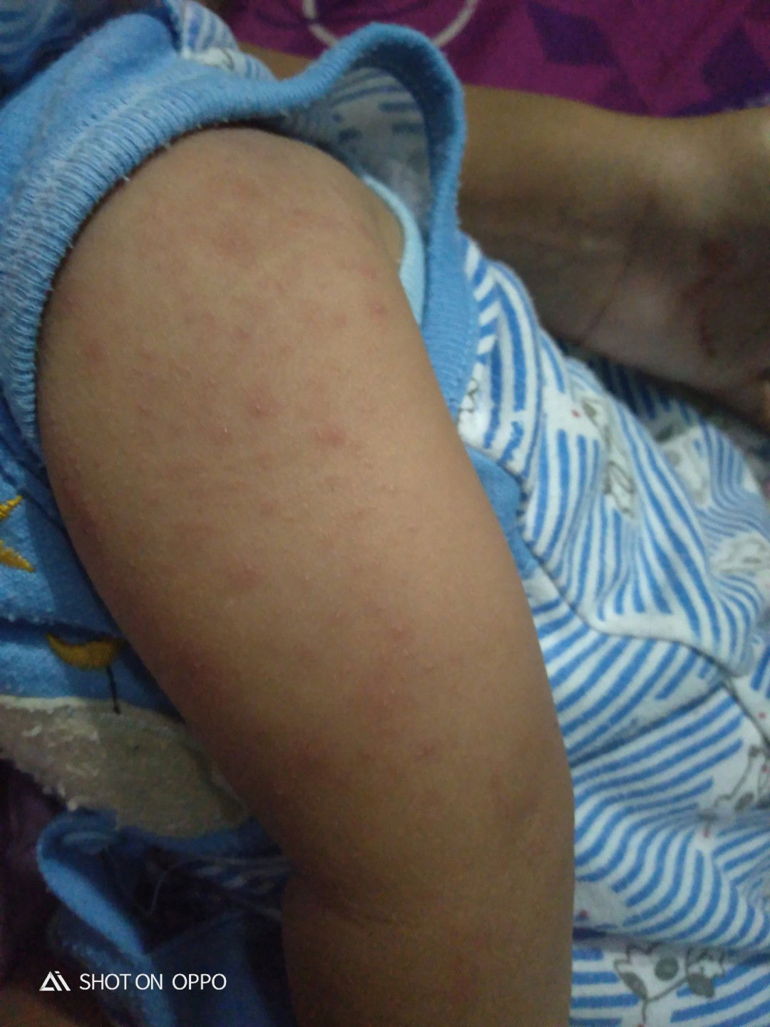 Biang keringat atau bukan ya bunda?