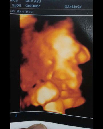 34week 2day sudah masuk panggul