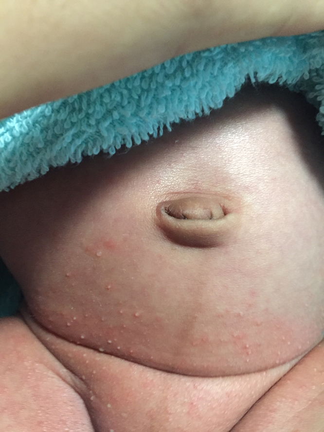 Ini ruamkah bun? Obatny apa y bun?