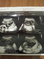 N_ Yani profile icon