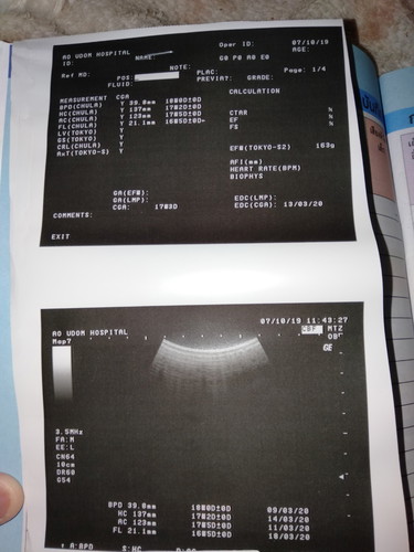 หมอนัดวันนี้ไปซาวด์มา4เดือน2อาทิตย์ แม่ๆช่วยดูหน่อยค่ะ