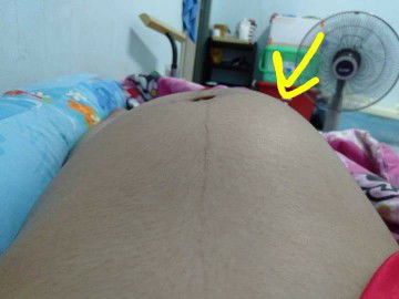 ถามแม่ๆหน่อยค่ะ ตอนนี้32+6วีค