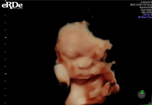 Yunita Anggraeni profile icon