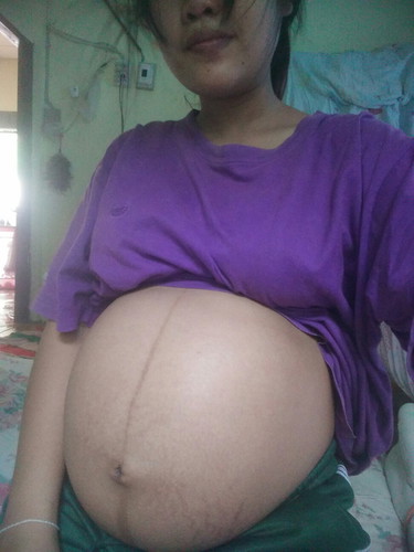37วีค 6วันคะ ท้องแรก กำหนมดคลอด 13สิงหานี้ค่ะกลัวการคลอดลูกมากๆ?