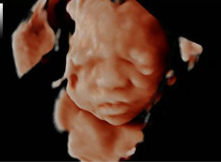 Rintan Haririn profile icon