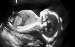 Rini Sugianto profile icon