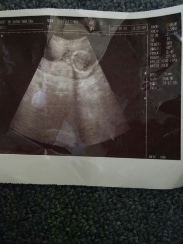 mengapa asil usg bisa ber beda2