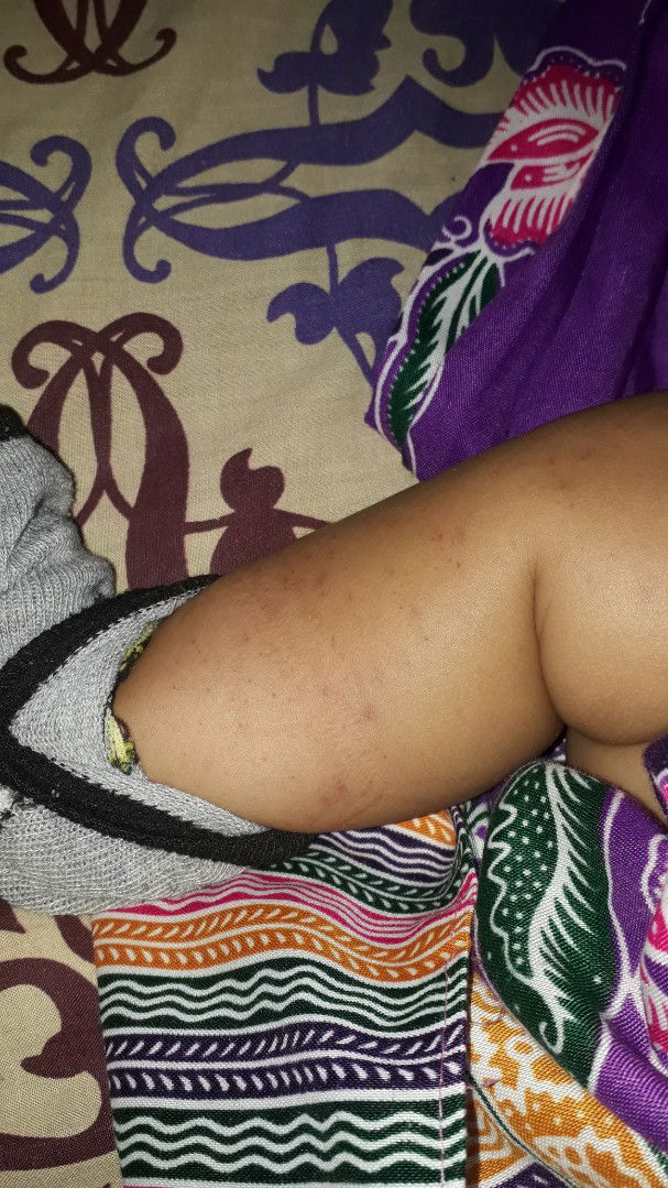 bintik merah pada kulit