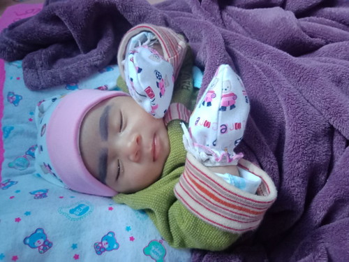 เรื่องของคิ้ว