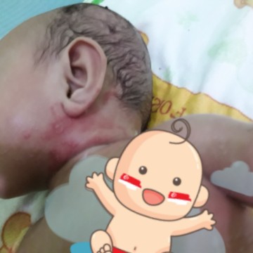 kulit bayiku