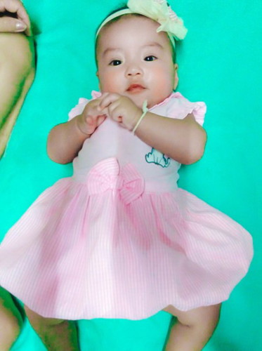 จ้ำม้ำ