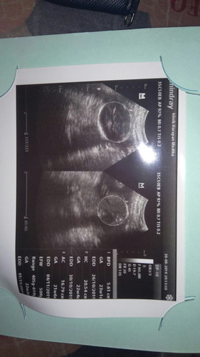 sekarang 25 week