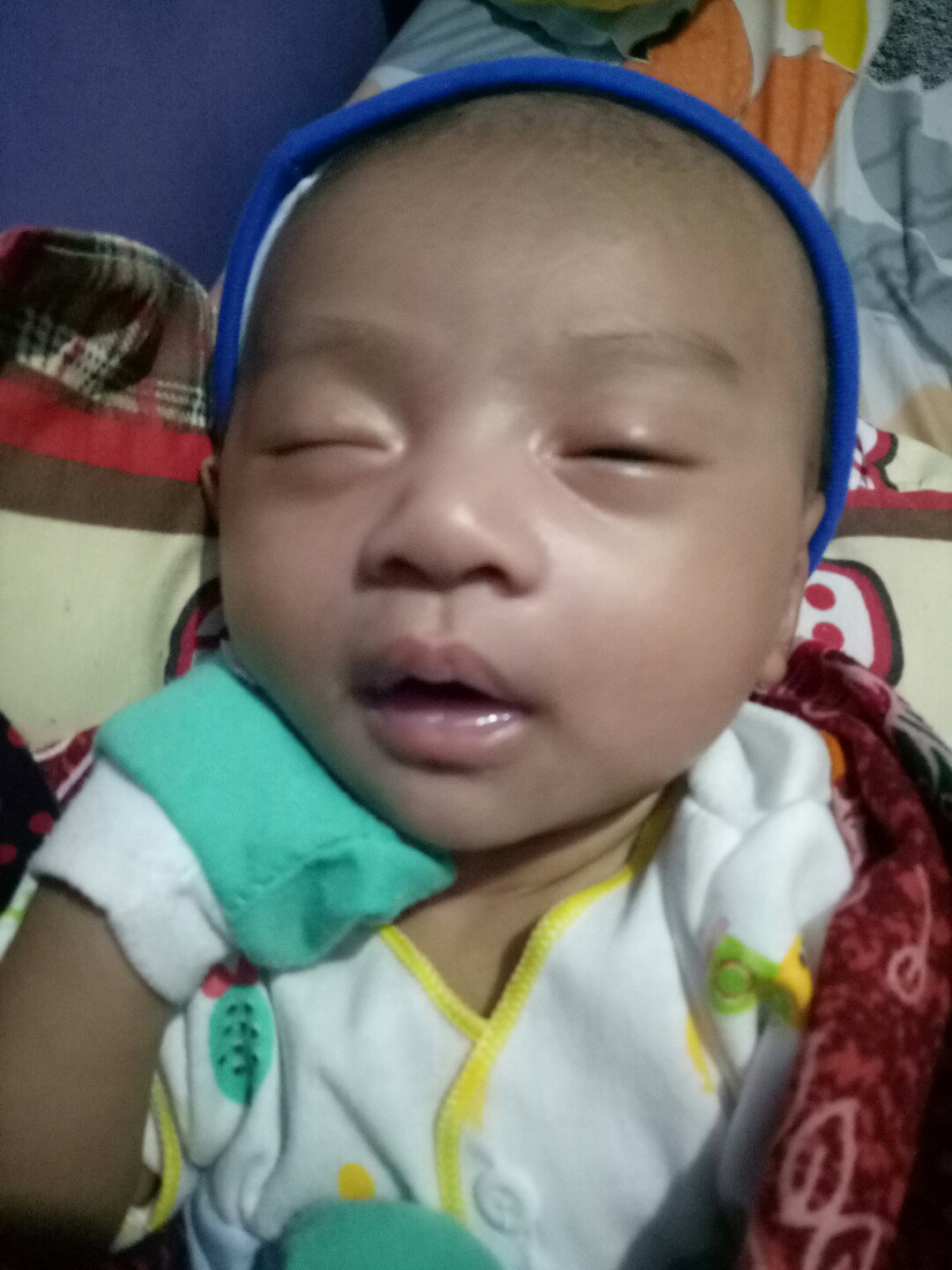 hidung mampet